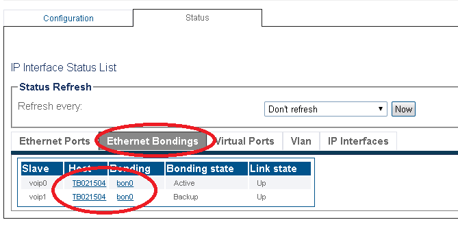 10b ip interfaces statues with bonding slaves status Box A